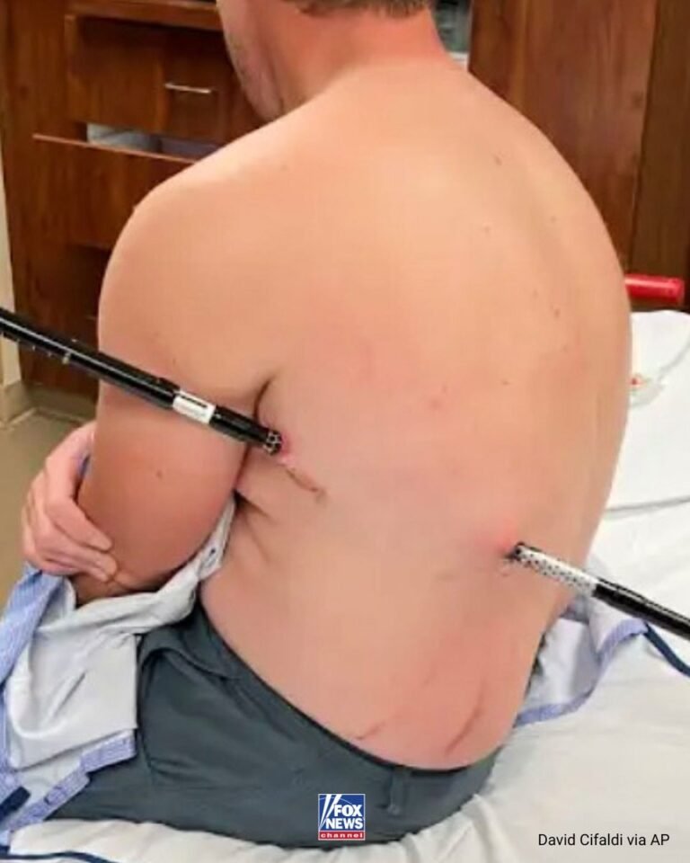 AVERTISSEMENT GRAPHIQUE : Une infirmière des urgences a parcouru plus de 16 km pour se mettre en sécurité…