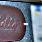 Les médicaments contre le diabète et l'obésité d'Eli Lilly dépassent les attentes ; Actions Pop