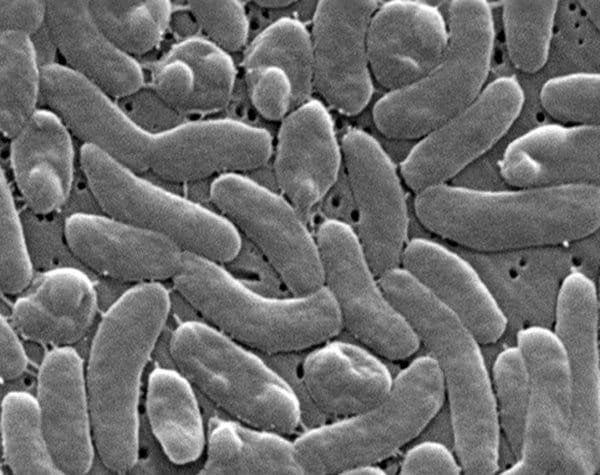 Les responsables de la santé appellent à la prudence les baigneurs de la côte du Golfe lors d'une vague d'infections bac