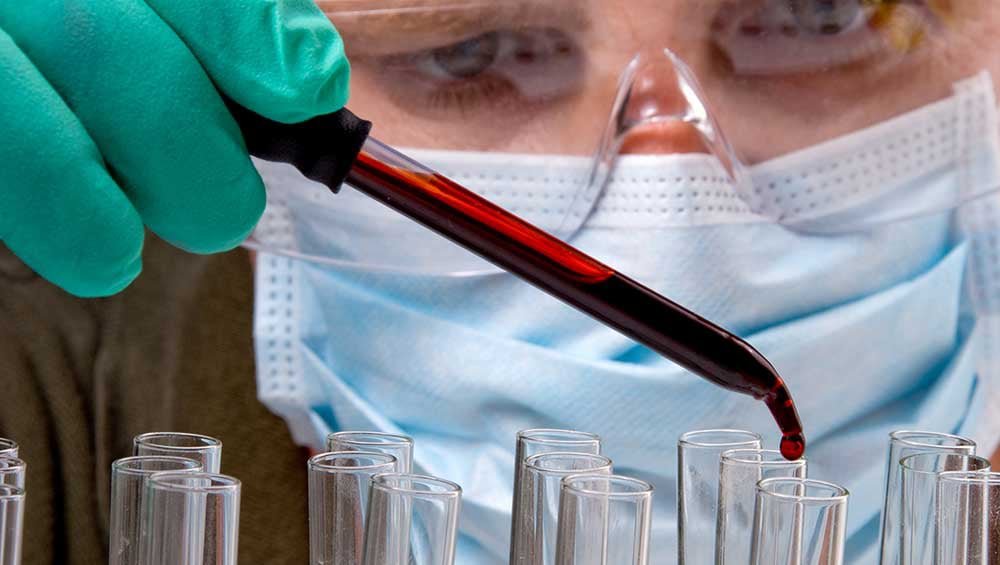 Novartis et Ionis échouent sur un échec surprise pour un médicament pour le cœur